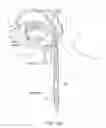 Fig. 35 - Methods and devices for non-invasive cerebral and systemic cooling alternating liquid mist/gas for induction and gas for maintenance