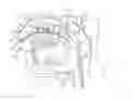 Fig. 01 - Devices for cooling the nasal cavity