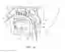 Fig. 09 - Devices for cooling the nasal cavity