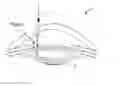 Fig. 01 - Apparatus for patterned plasma-mediated laser ophthalmic surgery