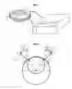 Fig. 02 - High intensity focused ultrasound device with a concave segment shaped transducers for treatment of ocular pathology