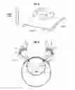 Fig. 05 - High intensity focused ultrasound device with a concave segment shaped transducers for treatment of ocular pathology