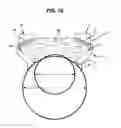 Fig. 06 - High intensity focused ultrasound device with a concave segment shaped transducers for treatment of ocular pathology