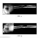 Fig. 05 - System for performing retina photostimulation