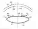 Fig. 01 - Method and apparatus for automated placement of scanned laser capsulorhexis incisions