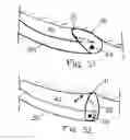 Fig. 35 - Spinal Therapy Apparatus