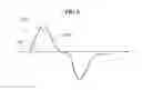 Fig. 06 - Walking assistance methods and apparatuses performing the same