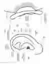 Fig. 02 - NERVE STIMULATION SYSTEM AND RELATED CONTROLLER