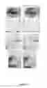 Fig. 02 - DERMAL REJUVENATION COMPOSITIONS AND METHODS