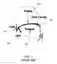 Fig. 02 - Oral anesthesia application