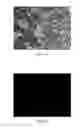 Fig. 02 - SELECTIVE INHIBITORS OF UNDIFFERENTIATED CELLS