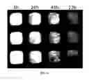 Fig. 07 - SELECTIVE INHIBITORS OF UNDIFFERENTIATED CELLS