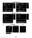 Fig. 05 - METHODS AND COMPOSITIONS FOR THE TREATMENT OF VASCULAR MALFORMATION