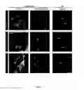 Fig. 06 - METHODS AND COMPOSITIONS FOR THE TREATMENT OF VASCULAR MALFORMATION