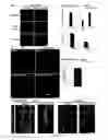 Fig. 07 - METHODS AND COMPOSITIONS FOR THE TREATMENT OF VASCULAR MALFORMATION