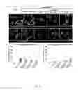Fig. 09 - METHODS AND COMPOSITIONS FOR THE TREATMENT OF VASCULAR MALFORMATION