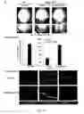 Fig. 23 - METHODS AND COMPOSITIONS FOR THE TREATMENT OF VASCULAR MALFORMATION