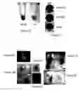 Fig. 02 - ANTICOAGULANT AND DECOAGULANT METHODS, COMPOSITIONS AND DEVICES