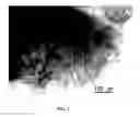Fig. 03 - Compositions and Methods for the Prevention and Treatment of Metabolic Diseases