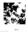Fig. 24 - Compositions and Methods for the Prevention and Treatment of Metabolic Diseases