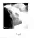Fig. 26 - Compositions and Methods for the Prevention and Treatment of Metabolic Diseases
