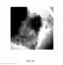 Fig. 27 - Compositions and Methods for the Prevention and Treatment of Metabolic Diseases