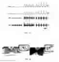 Fig. 34 - Compositions and methods for treating diseases