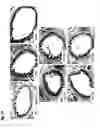 Fig. 15 - Purified extract (ATC1) isolated from var. subintegrum containing abundant amount of active ingredient, the preparation thereof, and the composition comprising the same as an active ingredient for preventing or treating inflammation, allergy and asthma