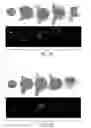 Fig. 03 - METHODS FOR PERFORMING A CORONARY ARTERY BYPASS GRAFT PROCEDURE