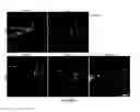 Fig. 06 - COMPOSITIONS AND METHODS FOR TREATING NEURODEGENERATIVE DISEASE