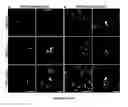 Fig. 07 - COMPOSITIONS AND METHODS FOR TREATING NEURODEGENERATIVE DISEASE