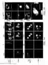 Fig. 02 - Mutant huntingtin-mediated protein dysfunction