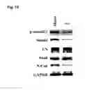 Fig. 10 - Peptide having fibrosis inhibitory activity and composition containing same