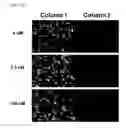 Fig. 18 - Pincers comprising antibody and aptamer conjugated via a linker which binds to the same target material and use thereof