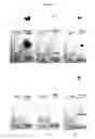 Fig. 08 - Polyamine-dihydroxybenzoic acid conjugate hydrogels as iron chelators