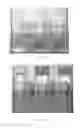 Fig. 18 - Injectable dendrimer hydrogel nanoparticles