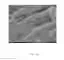 Fig. 26 - Injectable dendrimer hydrogel nanoparticles