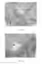 Fig. 33 - Injectable dendrimer hydrogel nanoparticles