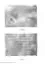 Fig. 34 - Injectable dendrimer hydrogel nanoparticles