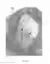 Fig. 35 - Injectable dendrimer hydrogel nanoparticles