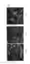 Fig. 41 - Injectable dendrimer hydrogel nanoparticles