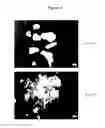 Fig. 05 - SUSTAINED-RELEASE DRUG FORMULATIONS FOR GLAUCOMA