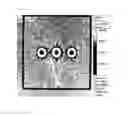 Fig. 03 - Multipurpose medical image indicator and method for manufacturing the same