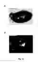 Fig. 17 - Biodegradable, thermally responsive injectable hydrogel for treatment of ischemic cardiomyopathy
