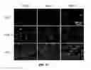 Fig. 24 - Biodegradable, thermally responsive injectable hydrogel for treatment of ischemic cardiomyopathy