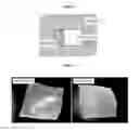 Fig. 04 - SILK MEDICAL DEVICES