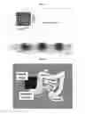 Fig. 05 - SILK MEDICAL DEVICES