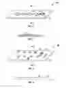 Fig. 02 - Implantable materials having engineered surfaces and method of making same