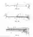 Fig. 04 - Sinus dilation catheter