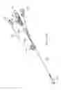 Fig. 13 - Sinus dilation catheter
